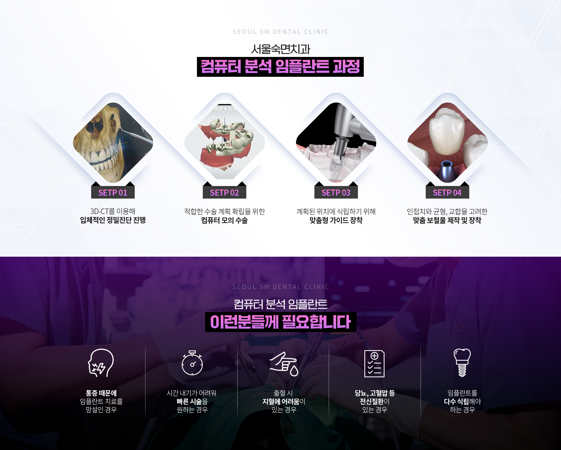네비게이션-임플란트-과정-3D-CT를-이용해-입체적인-정밀진단-진행-적합한-수술계획-확립을-위한-컴퓨터-모의-수술-계획된-위치에-식립하기-위해-맞춤형-원가이드-장착-인접치와-균형-교합을-고려한-맞춤-보철물-제작-및-장착