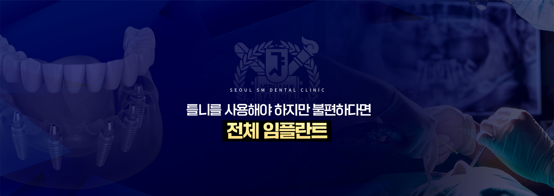틀니를-사용해야-하지만-불편하다면-전체임플란트