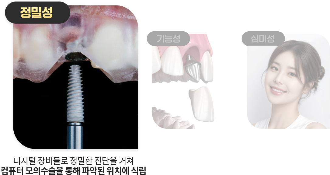 정밀성-디지털-장비들로-정밀한-진단을-거쳐-컴퓨터의-모의수술을-통해-파악된-위치에-식립