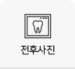 전후사진