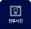 잔후사진
