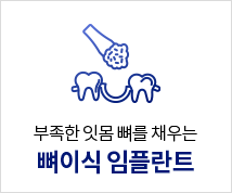 뼈이식-임플란트