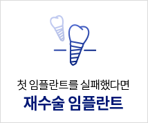 재수술-임플란트
